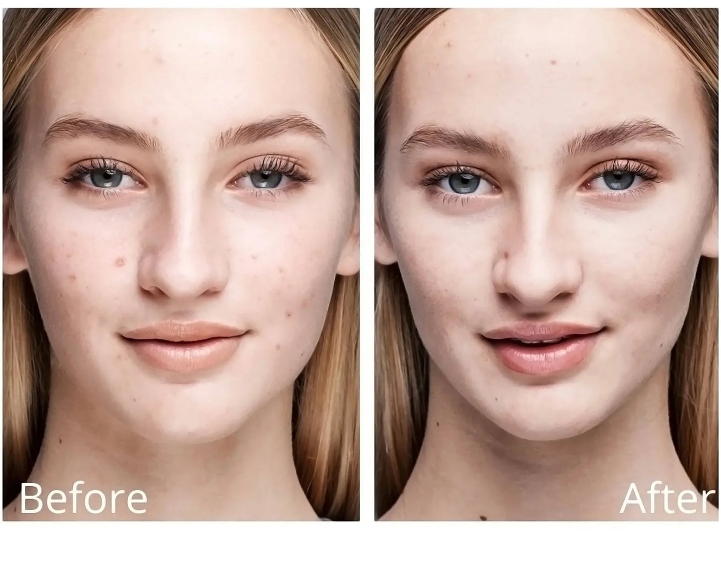 Outsmart Blemish Clarifying Treatment