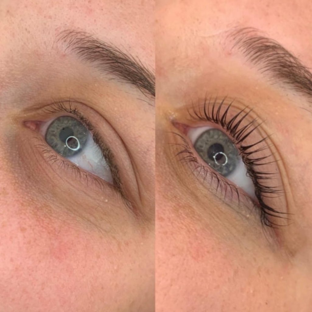 Lash and Brow Growth Serum