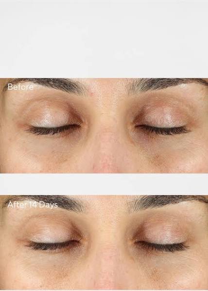 Essential-C Eye Cream BS SPF 15|PA++