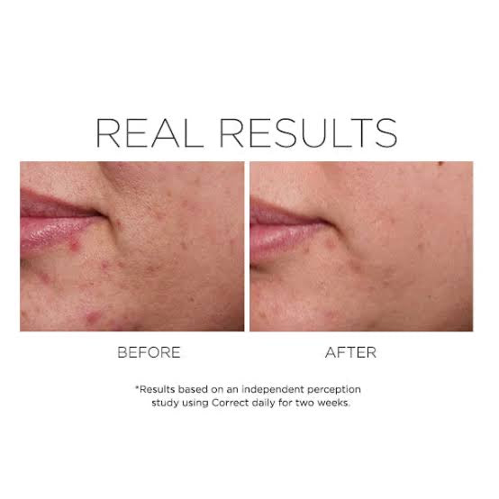 Rapid Relief Spot Treatment